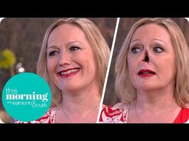 I Lost My Nose to an Autoimmune Disease and Now My New One Is Held on With Magnets | This Morning - YouTube