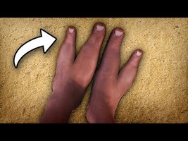 This African Tribe Has Only 2 Toes - YouTube